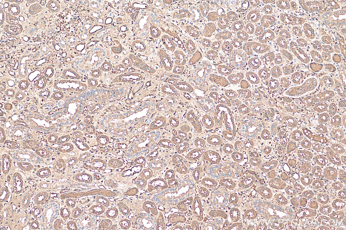Immunohistochemistry (IHC) staining of human kidney tissue using Prealbumin/transthyretin Polyclonal antibody (11891-1-AP)