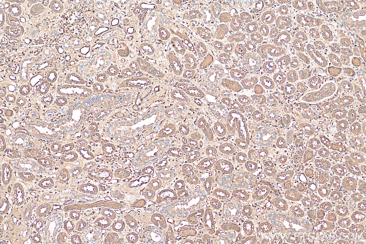 IHC staining of human kidney using 11891-1-AP