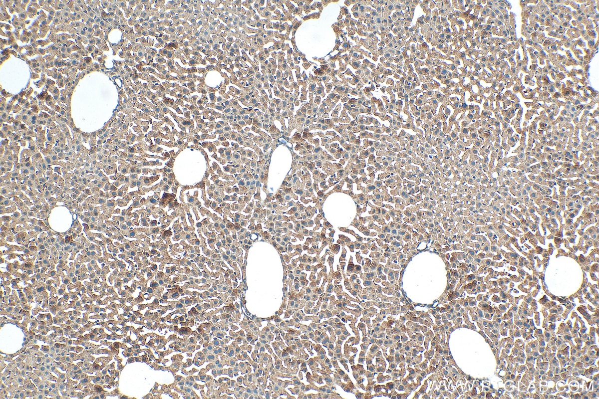 IHC staining of mouse liver using 11891-1-AP