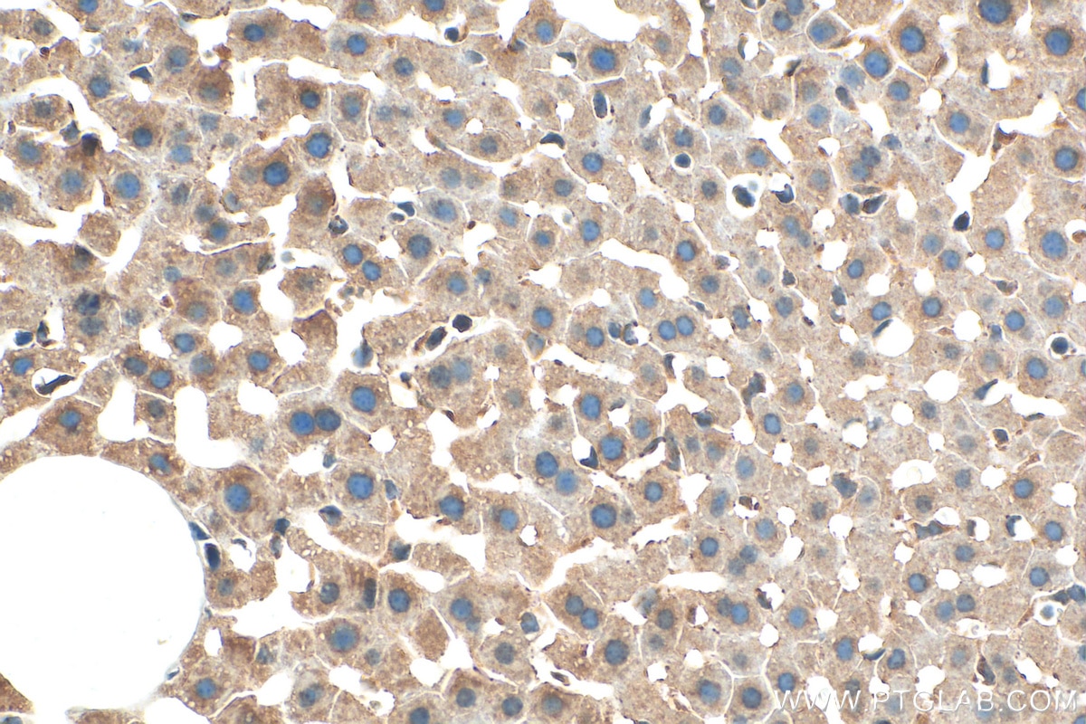Immunohistochemistry (IHC) staining of mouse liver tissue using Prealbumin/transthyretin Polyclonal antibody (11891-1-AP)