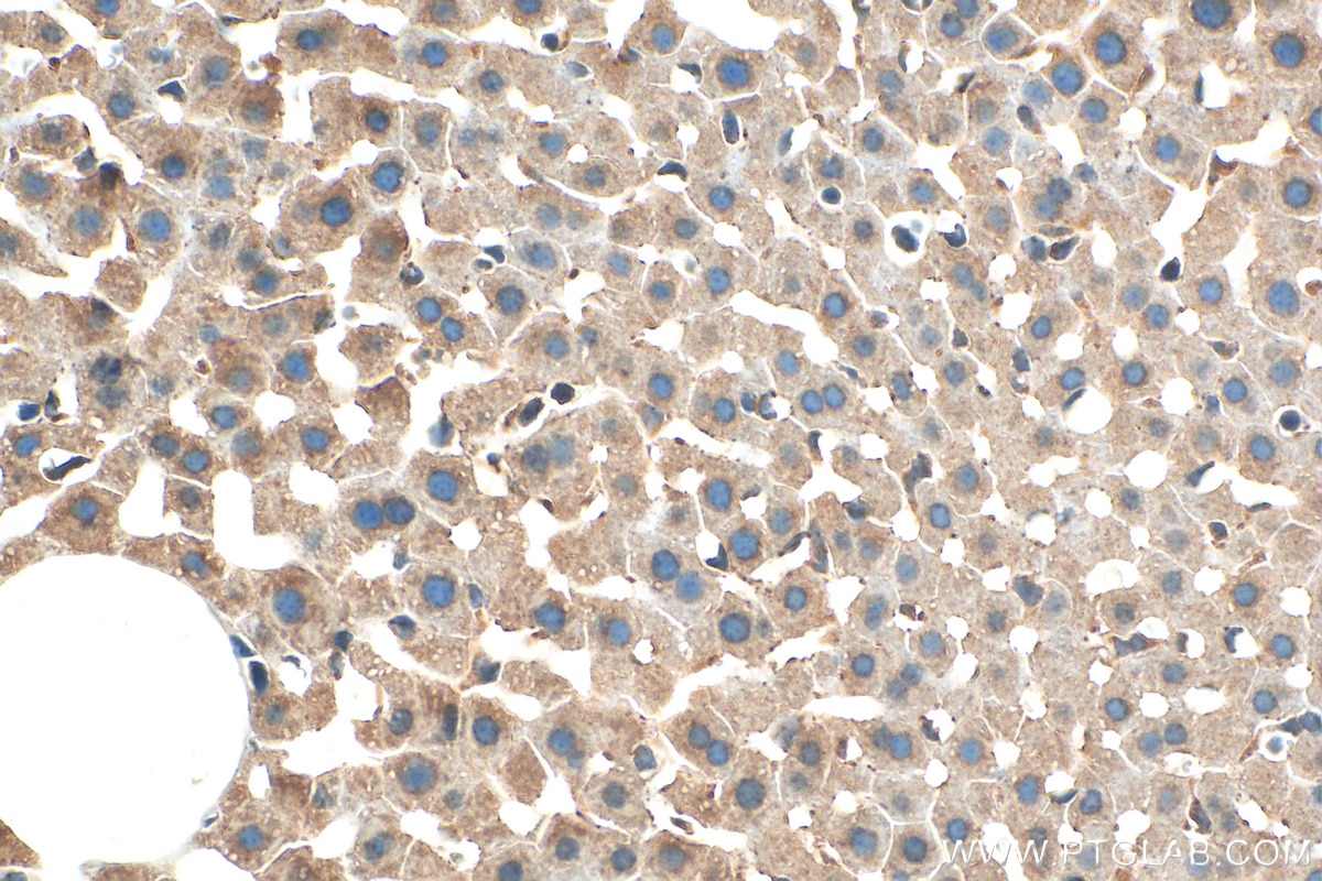 IHC staining of mouse liver using 11891-1-AP