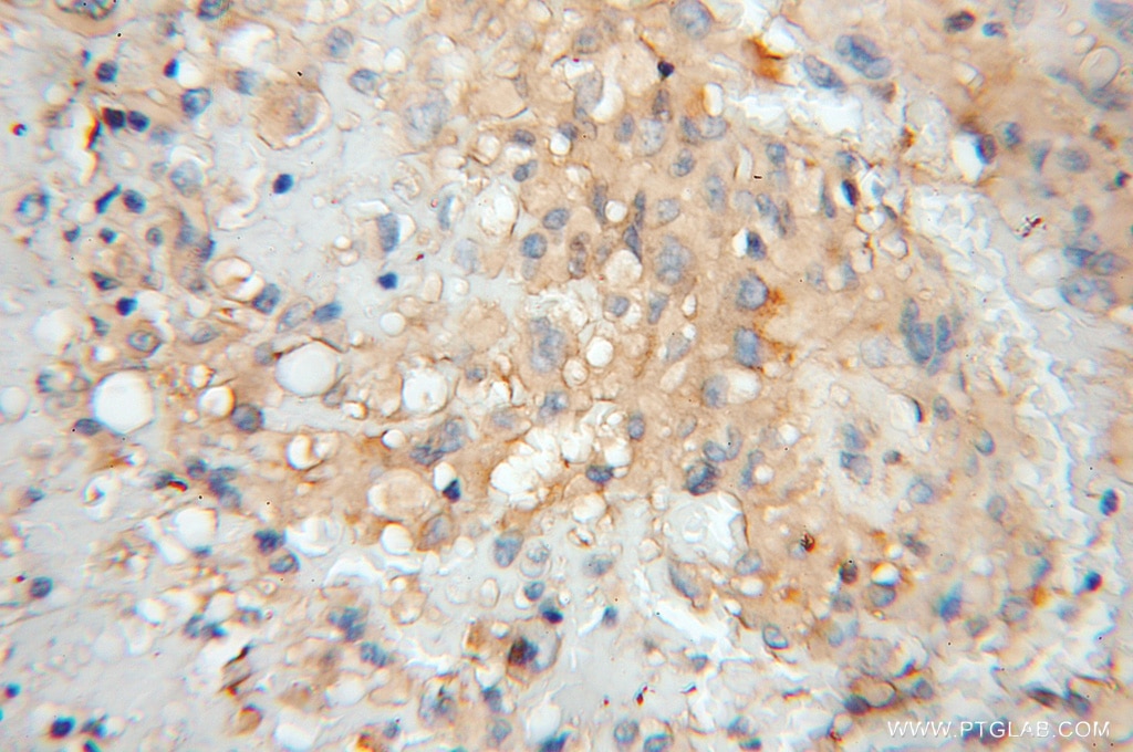 Prealbumin/transthyretin