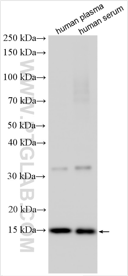Western Blot (WB) analysis of various lysates using Prealbumin/transthyretin Polyclonal antibody (11891-1-AP)