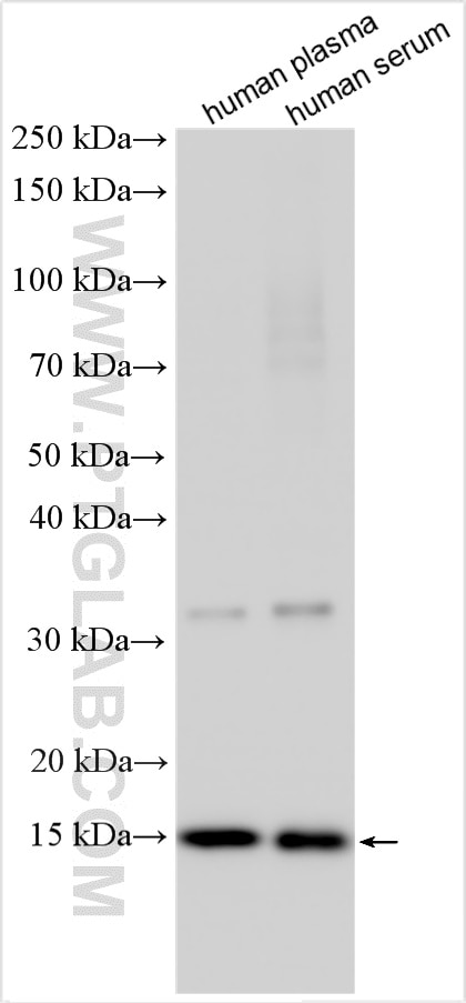 WB analysis using 11891-1-AP