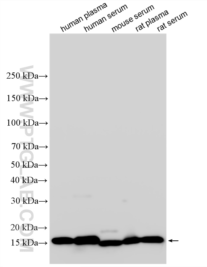 Western Blot (WB) analysis of various lysates using Prealbumin/transthyretin Polyclonal antibody (11891-1-AP)