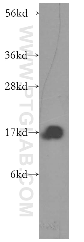 Western Blot (WB) analysis of human brain tissue using Prealbumin/transthyretin Polyclonal antibody (11891-1-AP)