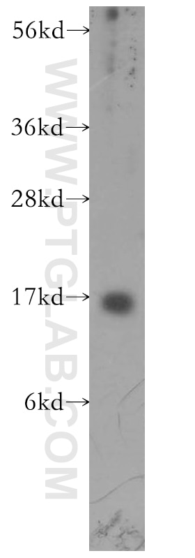 Western Blot (WB) analysis of human heart tissue using Prealbumin/transthyretin Polyclonal antibody (11891-1-AP)