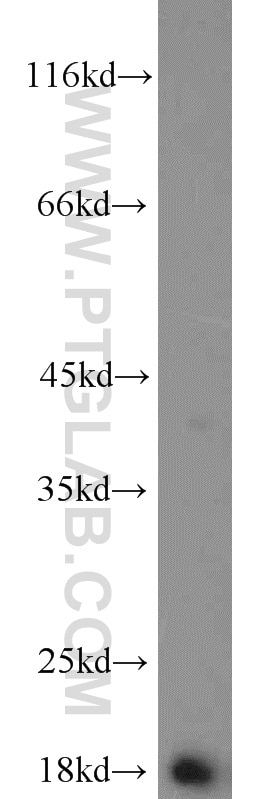 Western Blot (WB) analysis of human brain tissue using Prealbumin/transthyretin Polyclonal antibody (11891-1-AP)