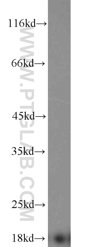 Western Blot (WB) analysis of human brain tissue using Prealbumin/transthyretin Polyclonal antibody (11891-1-AP)