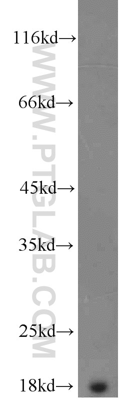 Western Blot (WB) analysis of human brain tissue using Prealbumin/transthyretin Polyclonal antibody (11891-1-AP)