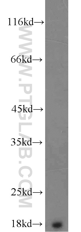 Western Blot (WB) analysis of human brain tissue using Prealbumin/transthyretin Polyclonal antibody (11891-1-AP)