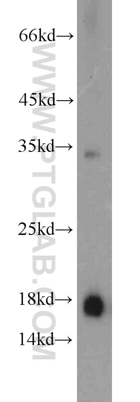 Western Blot (WB) analysis of human plasma using Prealbumin/transthyretin Polyclonal antibody (11891-1-AP)