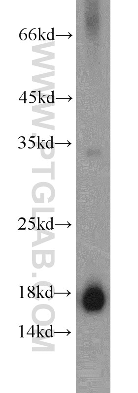 WB analysis of human plasma using 11891-1-AP