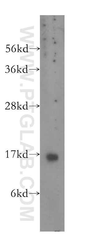 Western Blot (WB) analysis of human liver tissue using Prealbumin/transthyretin Polyclonal antibody (11891-1-AP)