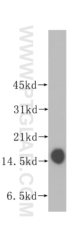 Western Blot (WB) analysis of human spleen tissue using Prealbumin/transthyretin Polyclonal antibody (11891-1-AP)