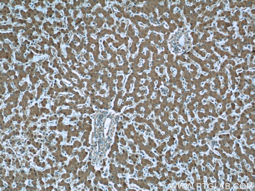 Immunohistochemistry (IHC) staining of human liver tissue using Prealbumin/transthyretin Monoclonal antibody (66108-1-Ig)