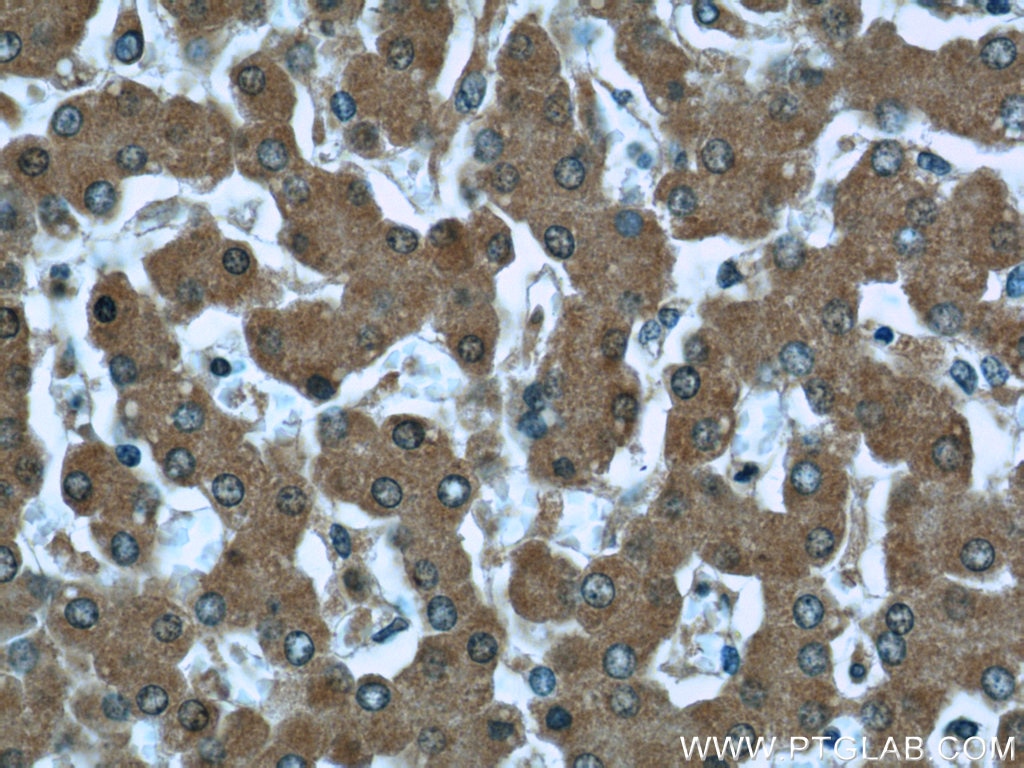 Immunohistochemistry (IHC) staining of human liver tissue using Prealbumin/transthyretin Monoclonal antibody (66108-1-Ig)