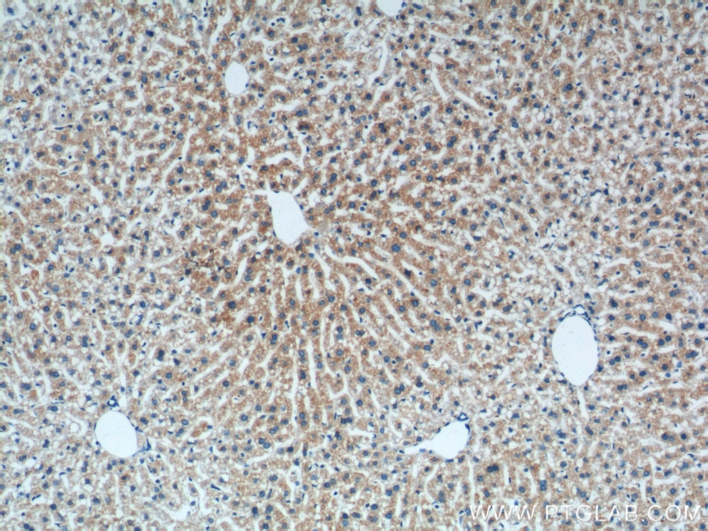 Immunohistochemistry (IHC) staining of mouse liver tissue using Prealbumin/transthyretin Monoclonal antibody (66108-1-Ig)