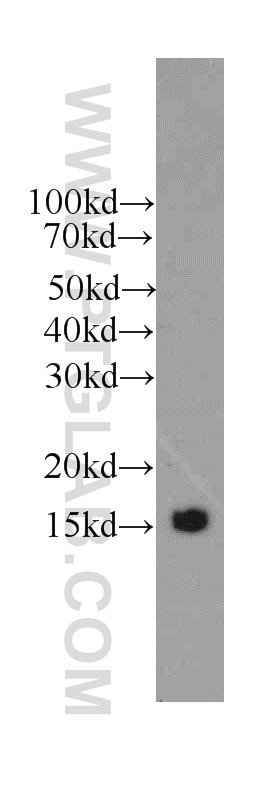 Western Blot (WB) analysis of human brain tissue using Prealbumin/transthyretin Monoclonal antibody (66108-1-Ig)