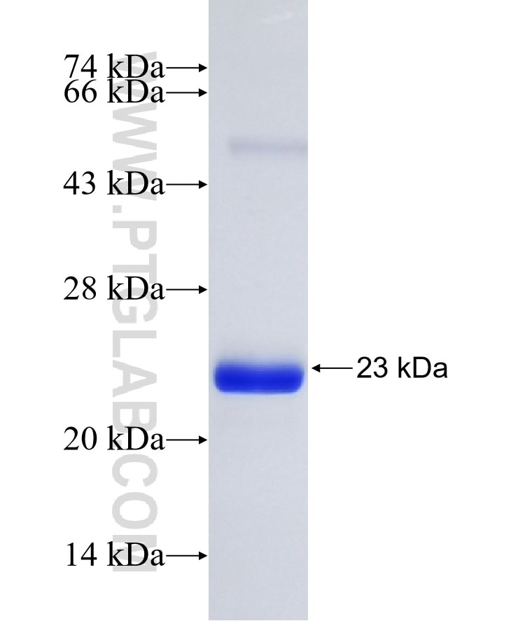 TTR fusion protein Ag19232 SDS-PAGE
