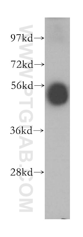 Western Blot (WB) analysis of human spleen tissue using TTRAP Polyclonal antibody (12203-1-AP)