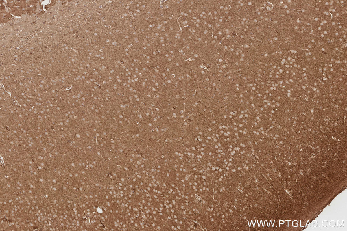 IHC staining of mouse brain using 26973-1-AP Immunohistochemistry (IHC) staining of mouse brain tissue using TTYH1 Polyclonal antibody (26973-1-AP)