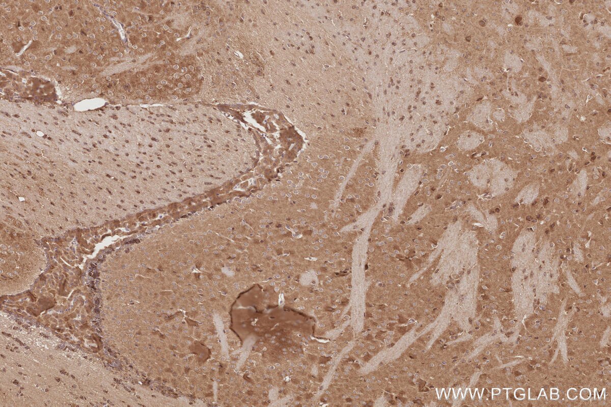 IHC staining of mouse brain using 26973-1-AP Immunohistochemistry (IHC) staining of mouse brain tissue using TTYH1 Polyclonal antibody (26973-1-AP)