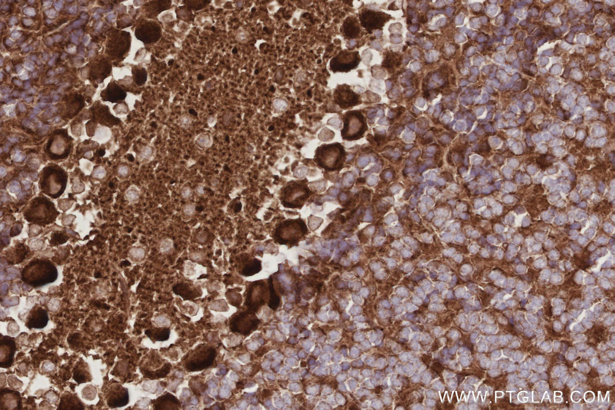 IHC staining of mouse cerebellum using 26973-1-AP Immunohistochemistry (IHC) staining of mouse cerebellum tissue using TTYH1 Polyclonal antibody (26973-1-AP)