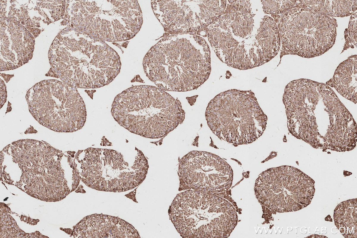 IHC staining of mouse testis using 26973-1-AP Immunohistochemistry (IHC) staining of mouse testis tissue using TTYH1 Polyclonal antibody (26973-1-AP)