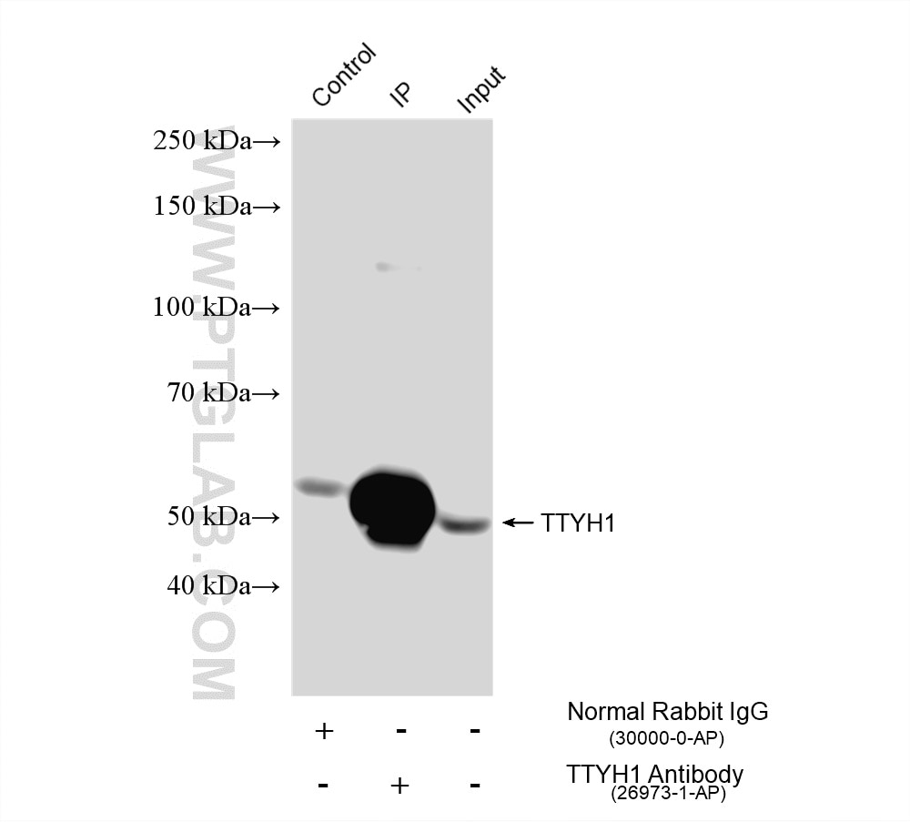 Immunoprecipitation (IP) experiment of pig brain tissue using TTYH1 Polyclonal antibody (26973-1-AP)