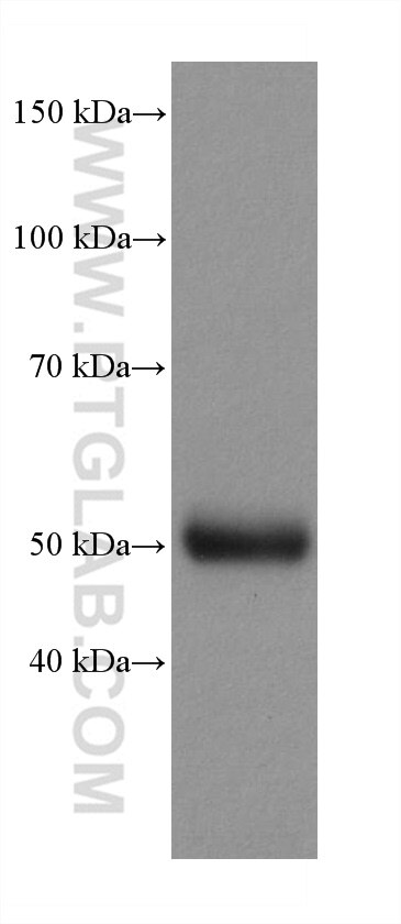 Western Blot (WB) analysis of human testis tissue using TTYH1 Recombinant antibody (80263-1-RR)