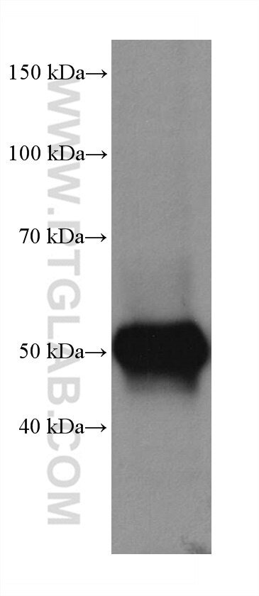 Western Blot (WB) analysis of rabbit cerebellum tissue using TTYH1 Recombinant antibody (80263-1-RR)