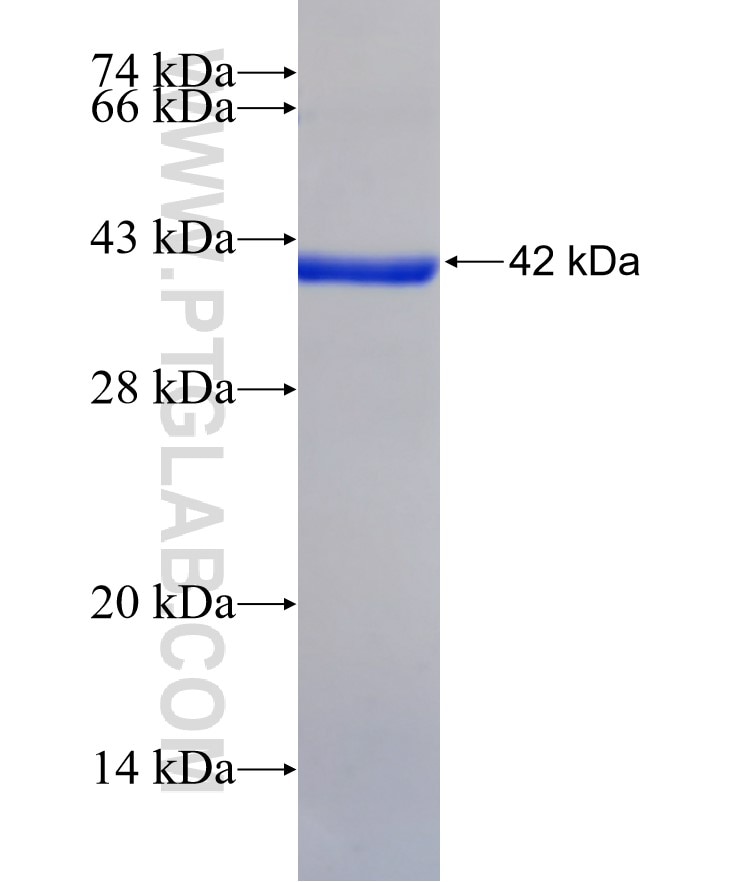 TTYH3 fusion protein Ag18804 SDS-PAGE