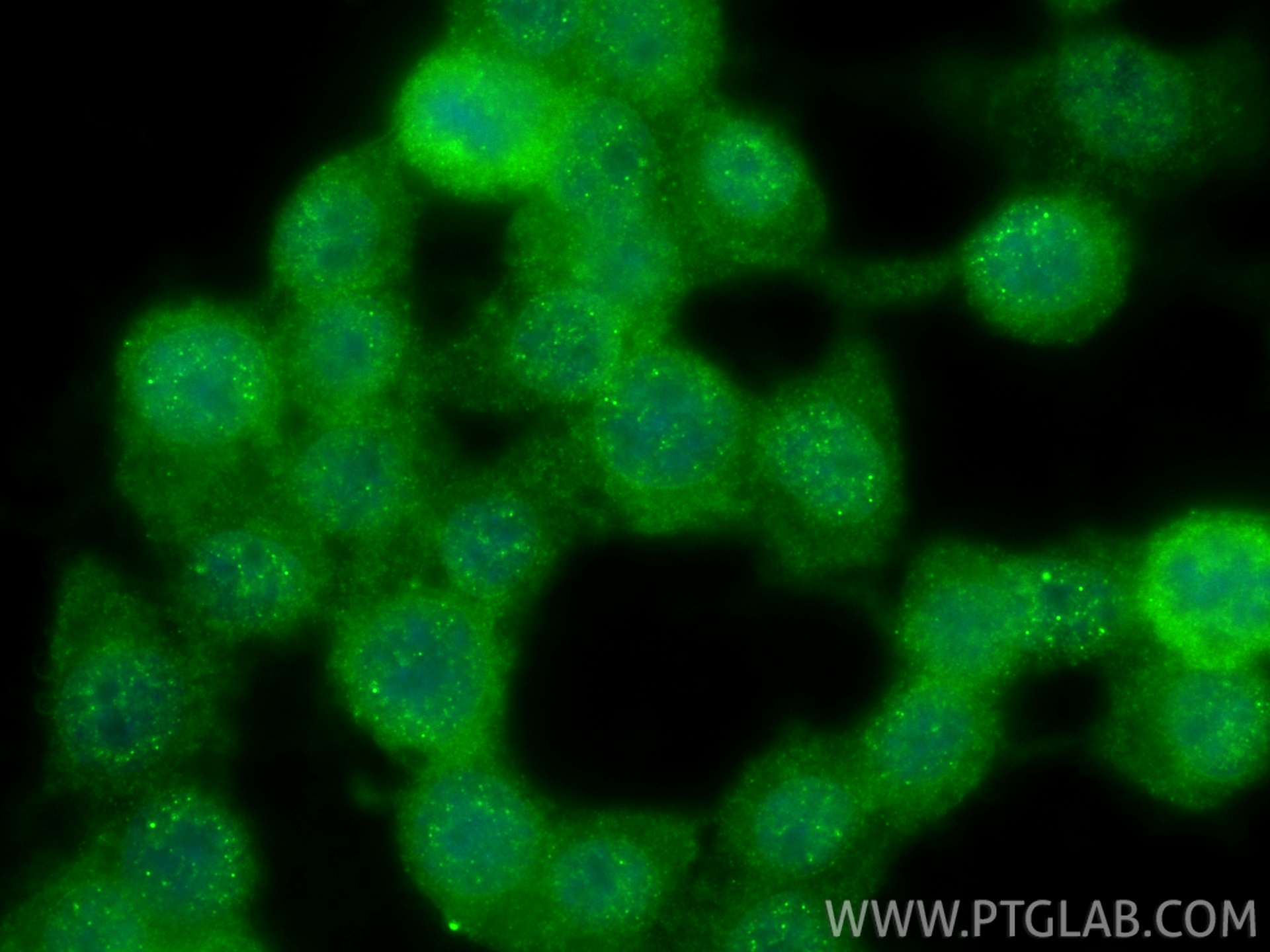 Immunofluorescence (IF) / fluorescent staining of Neuro-2a cells using TUB Polyclonal antibody (17928-1-AP)