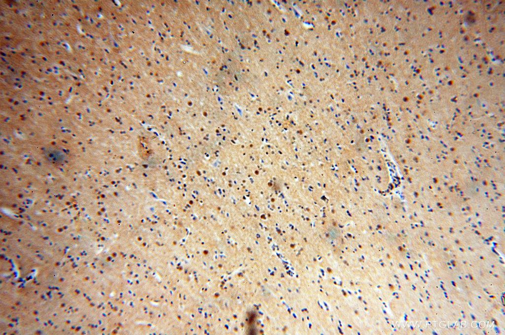 Immunohistochemistry (IHC) staining of human brain tissue using TUB Polyclonal antibody (17928-1-AP)