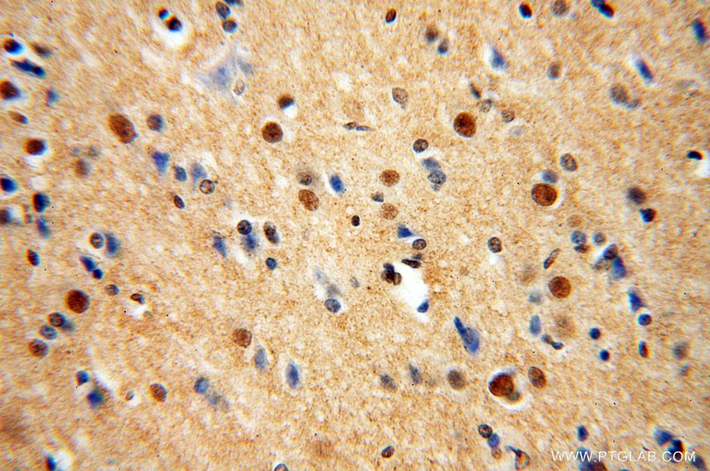 Immunohistochemistry (IHC) staining of human brain tissue using TUB Polyclonal antibody (17928-1-AP)