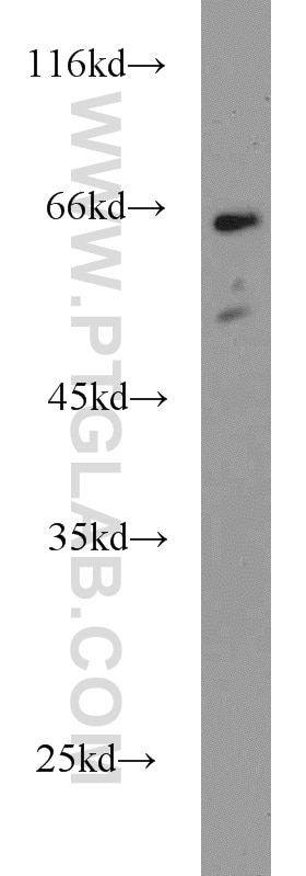 Western Blot (WB) analysis of mouse uterus tissue using TUB Polyclonal antibody (17928-1-AP)