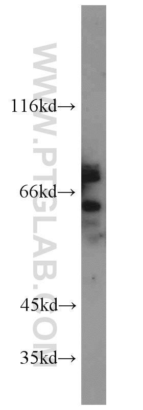 Western Blot (WB) analysis of rat brain tissue using TUB Polyclonal antibody (17928-1-AP)