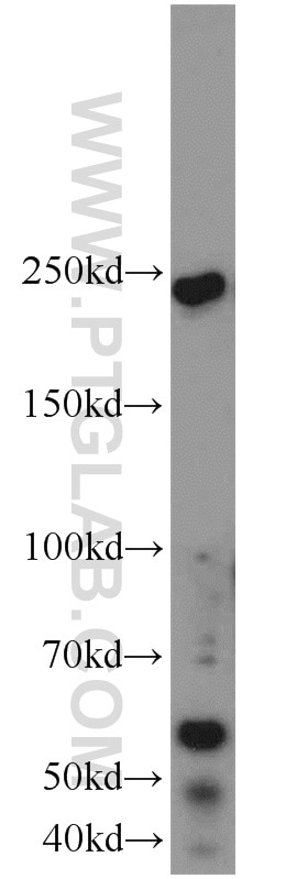 Western Blot (WB) analysis of mouse brain tissue using TUB Polyclonal antibody (17928-1-AP)