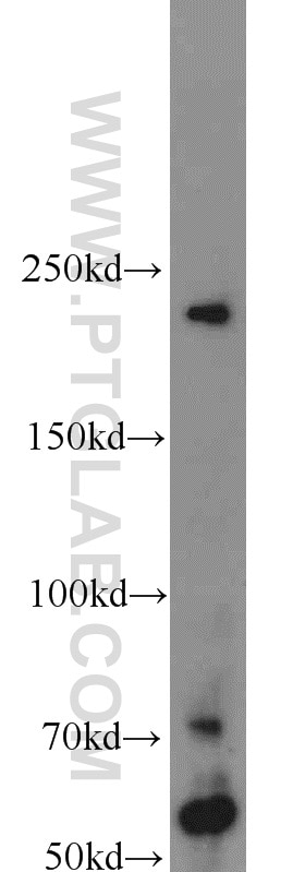 Western Blot (WB) analysis of Neuro-2a cells using TUB Polyclonal antibody (17928-1-AP)