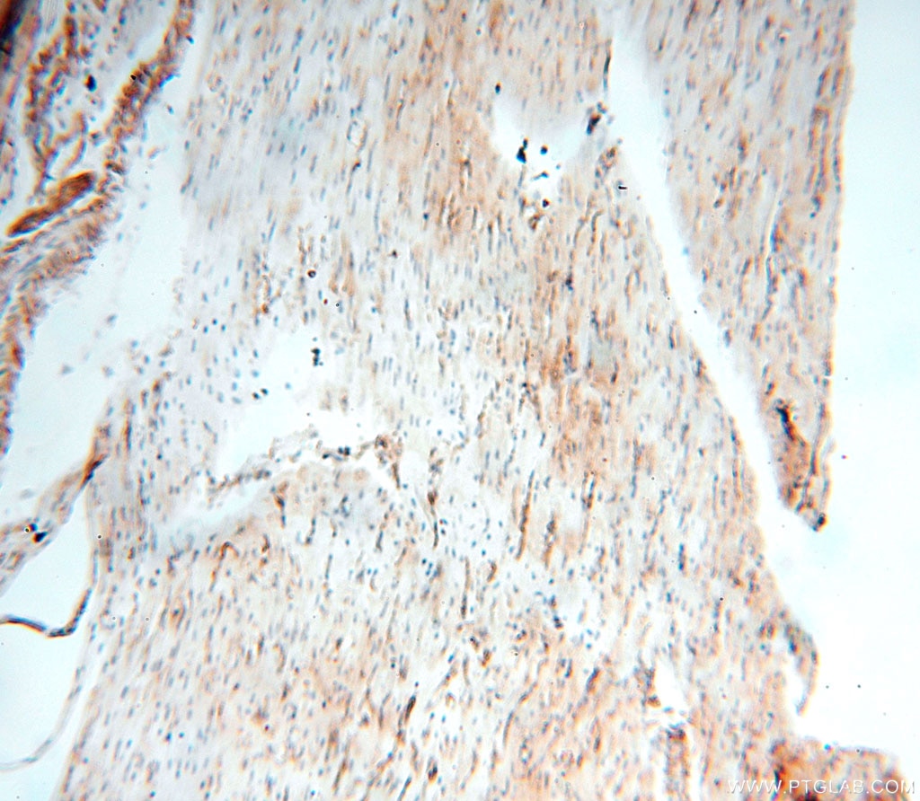 Immunohistochemistry (IHC) staining of human heart tissue using Alpha Tubulin Polyclonal antibody (10759-1-AP)
