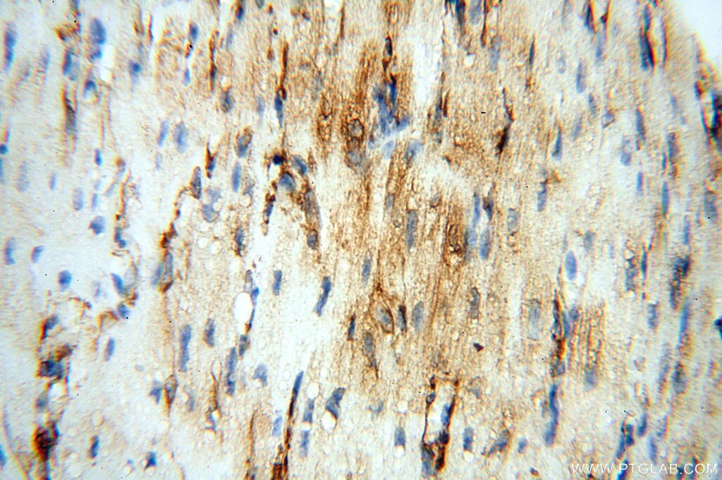 Immunohistochemistry (IHC) staining of human heart tissue using Alpha Tubulin Polyclonal antibody (10759-1-AP)