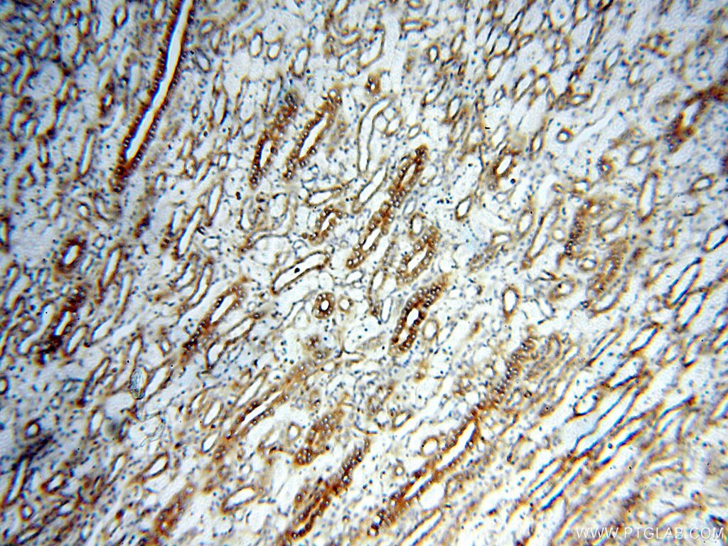 Immunohistochemistry (IHC) staining of human kidney tissue using Alpha Tubulin Polyclonal antibody (10759-1-AP)