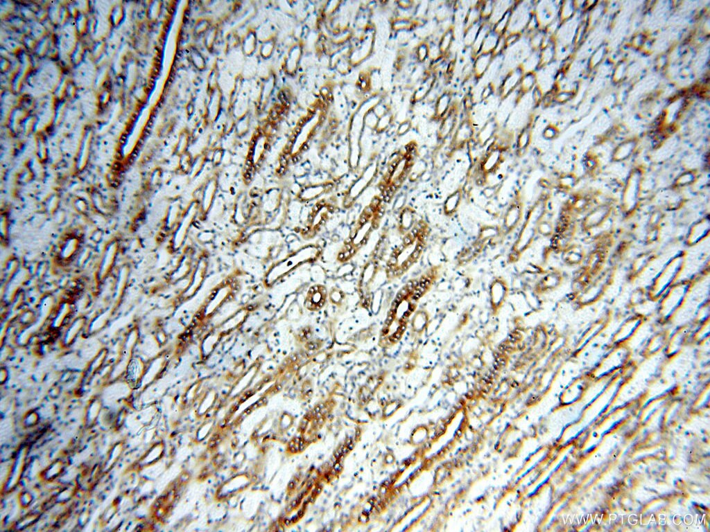 Immunohistochemistry (IHC) staining of human kidney tissue using Alpha Tubulin Polyclonal antibody (10759-1-AP)