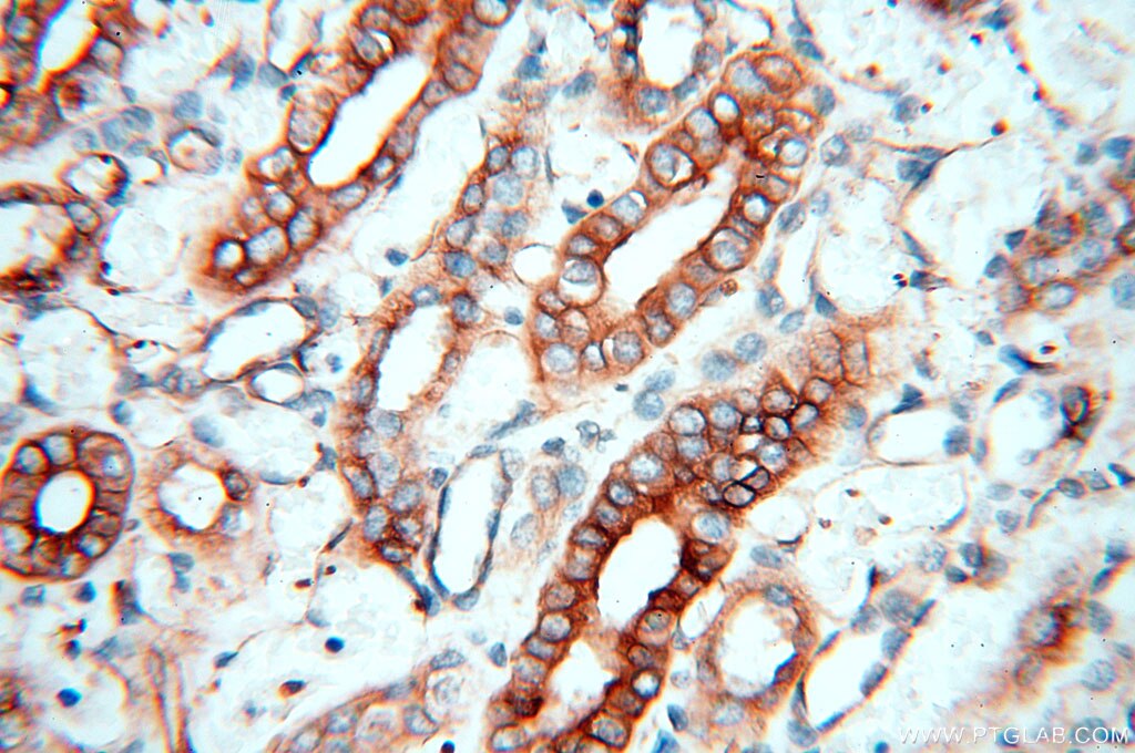 Immunohistochemistry (IHC) staining of human kidney tissue using Alpha Tubulin Polyclonal antibody (10759-1-AP)