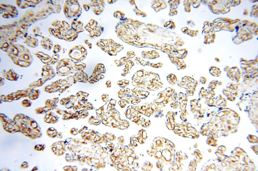 Immunohistochemistry (IHC) staining of human placenta tissue using Alpha Tubulin Polyclonal antibody (10759-1-AP)