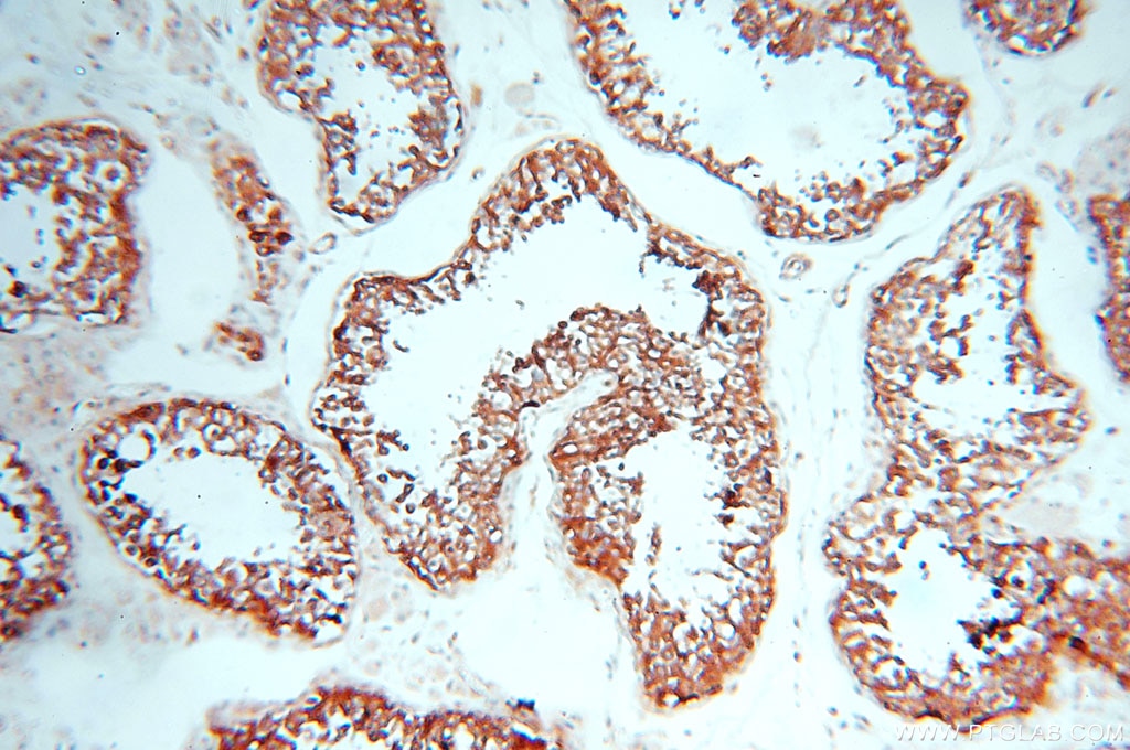 Immunohistochemistry (IHC) staining of human testis tissue using Alpha Tubulin Polyclonal antibody (10759-1-AP)