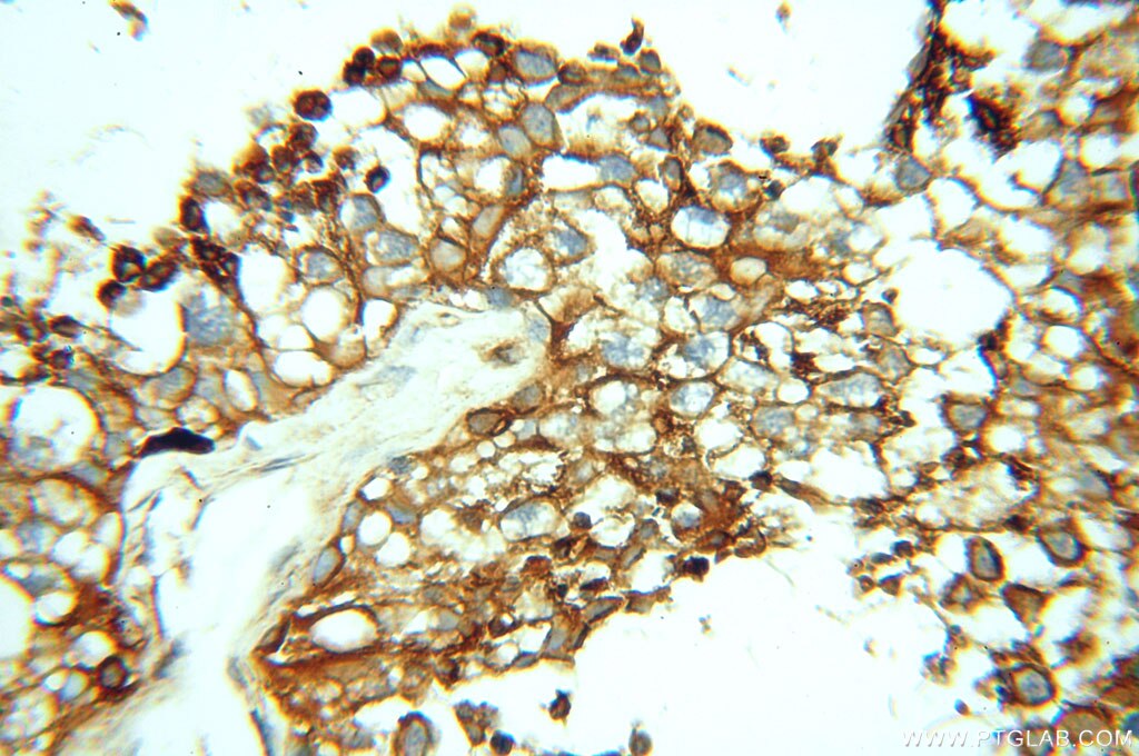 IHC staining of human testis using 10759-1-AP