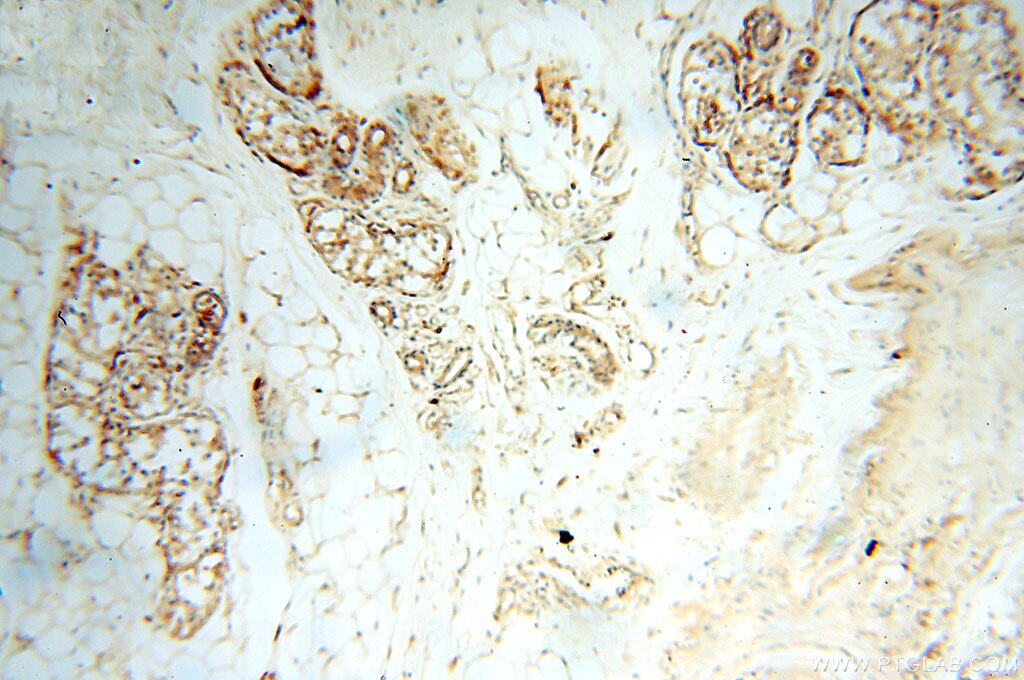 Immunohistochemistry (IHC) staining of human skin tissue using Alpha Tubulin Polyclonal antibody (10759-1-AP)