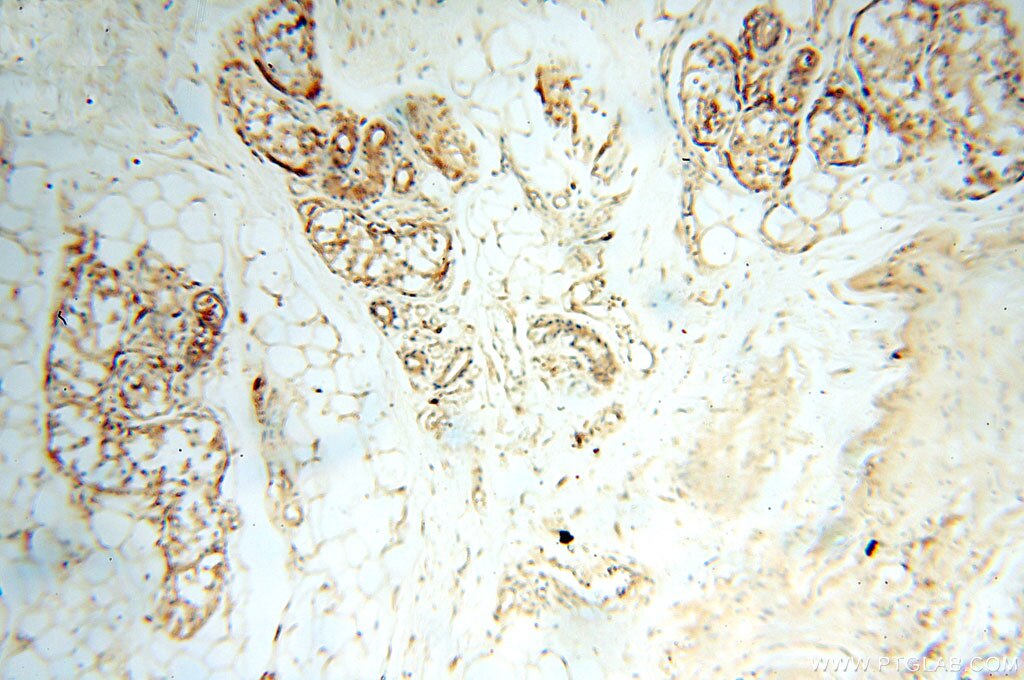 IHC staining of human skin using 10759-1-AP